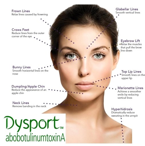 Dysport - Myers Dermatology & Clinical Spa