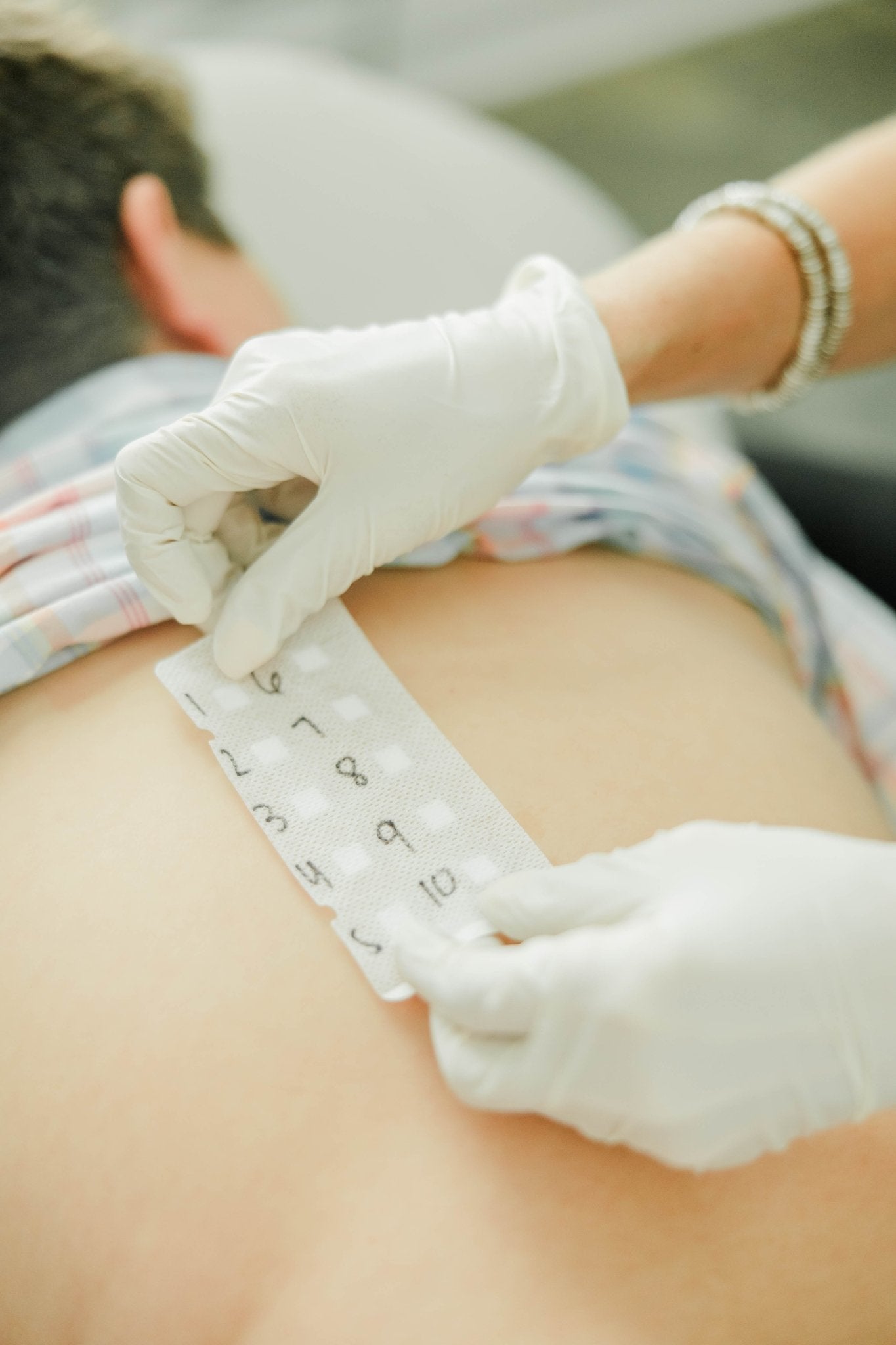 Patch Testing - Myers Dermatology & Clinical Spa
