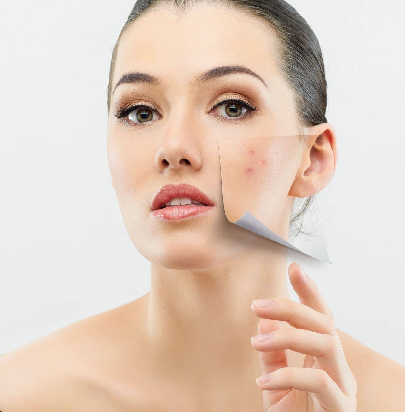 Normal skin type | Myers Dermatology & Clinical Spa