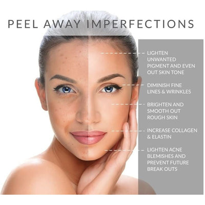 Professional Peels - Myers Dermatology & Clinical Spa